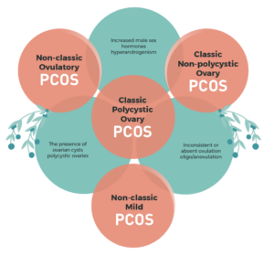 Which PCOS Type are You?